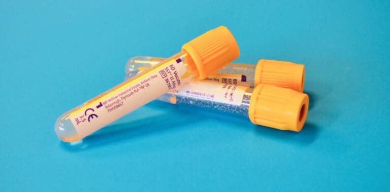 001 How long does ketamine stay in the system