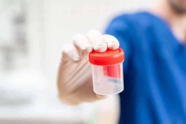 Drug Test Image